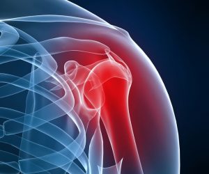 Best SLAP Tear Doctor in NYC _ NY Bone & Joint Best SLAP Tear Doctor in NYC _ NY Bone & Joint
